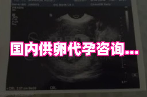 长春助孕网 4